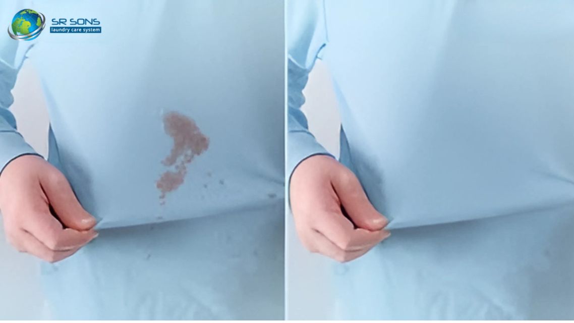You are currently viewing How To Remove Oil Stains From Clothes